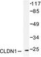 Claudin 1 antibody, LS-C175963, Lifespan Biosciences, Western Blot image 
