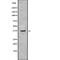 Acyl-CoA Wax Alcohol Acyltransferase 1 antibody, abx148469, Abbexa, Western Blot image 