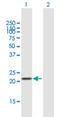 Laeverin antibody, H00206338-B01P, Novus Biologicals, Western Blot image 