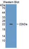 Smoothelin antibody, LS-C702961, Lifespan Biosciences, Western Blot image 