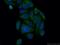 Synoviolin 1 antibody, 13473-1-AP, Proteintech Group, Immunofluorescence image 
