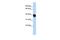 Tyrosylprotein Sulfotransferase 2 antibody, GTX46685, GeneTex, Western Blot image 