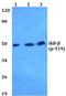 NFKB Inhibitor Beta antibody, PA5-36772, Invitrogen Antibodies, Western Blot image 