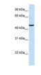 Kynurenine Aminotransferase 3 antibody, NBP1-57482, Novus Biologicals, Western Blot image 