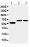 Solute Carrier Family 1 Member 4 antibody, PA2186, Boster Biological Technology, Western Blot image 