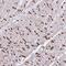 Solute Carrier Family 16 Member 6 antibody, NBP2-31578, Novus Biologicals, Immunohistochemistry paraffin image 