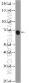 Zinc Finger Protein 251 antibody, 25601-1-AP, Proteintech Group, Western Blot image 