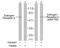 Estrogen Receptor 1 antibody, NB100-81909, Novus Biologicals, Western Blot image 