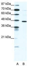 Gamma-Aminobutyric Acid Type A Receptor Pi Subunit antibody, TA330440, Origene, Western Blot image 