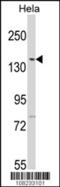 Lemur Tyrosine Kinase 2 antibody, 62-681, ProSci, Western Blot image 