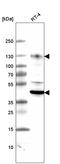 Lysosomal Associated Membrane Protein 1 antibody, AMAb91298, Atlas Antibodies, Western Blot image 