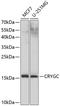 Crystallin Gamma C antibody, A05734, Boster Biological Technology, Western Blot image 