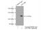 Nicotinamide Nucleotide Transhydrogenase antibody, 13442-2-AP, Proteintech Group, Immunoprecipitation image 