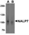 NLR Family Pyrin Domain Containing 7 antibody, A07838, Boster Biological Technology, Western Blot image 