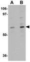 Transmembrane protein 214 antibody, GTX85257, GeneTex, Western Blot image 