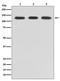 ABL Proto-Oncogene 2, Non-Receptor Tyrosine Kinase antibody, M02715, Boster Biological Technology, Western Blot image 