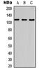 Cbl Proto-Oncogene antibody, GTX55004, GeneTex, Western Blot image 