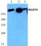 Microtubule Associated Serine/Threonine Kinase Family Member 4 antibody, PA5-36976, Invitrogen Antibodies, Western Blot image 