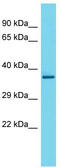 Transcription Elongation Factor A2 antibody, TA341817, Origene, Western Blot image 