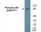 Glucocorticoid receptor antibody, EKC1987, Boster Biological Technology, Western Blot image 