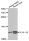 Defensin Beta 132 antibody, abx000997, Abbexa, Western Blot image 