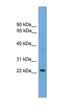 RAB39A, Member RAS Oncogene Family antibody, orb330906, Biorbyt, Western Blot image 