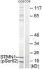 PP17 antibody, 79-836, ProSci, Western Blot image 