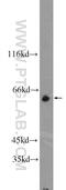 Zinc Finger Protein 571 antibody, 25302-1-AP, Proteintech Group, Western Blot image 