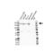 TSC Complex Subunit 2 antibody, VPA00214, Bio-Rad (formerly AbD Serotec) , Western Blot image 