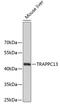 Trafficking Protein Particle Complex 13 antibody, 19-082, ProSci, Western Blot image 