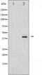 Nucleophosmin 1 antibody, abx010329, Abbexa, Western Blot image 