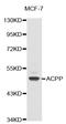 Acid Phosphatase, Prostate antibody, LS-C331779, Lifespan Biosciences, Western Blot image 