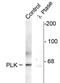 Polo Like Kinase 1 antibody, 480028, Invitrogen Antibodies, Western Blot image 