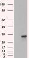 Proteasome Inhibitor Subunit 1 antibody, EB05845, Everest Biotech, Western Blot image 