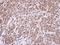 DNA Topoisomerase II Alpha antibody, GTX100689, GeneTex, Immunohistochemistry paraffin image 