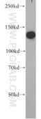 Receptor Tyrosine Kinase Like Orphan Receptor 1 antibody, 20629-1-AP, Proteintech Group, Western Blot image 