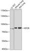 Kinesin Family Member 2B antibody, 22-256, ProSci, Western Blot image 