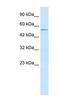 ZFP91 Zinc Finger Protein antibody, NBP1-80138, Novus Biologicals, Western Blot image 