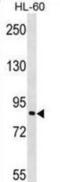 TGF-Beta Activated Kinase 1 (MAP3K7) Binding Protein 3 antibody, abx029258, Abbexa, Western Blot image 