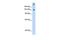 Splicing Factor 3b Subunit 1 antibody, GTX47417, GeneTex, Western Blot image 