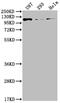 Fibroblast Growth Factor Receptor 3 antibody, CSB-RA966627A0HU, Cusabio, Western Blot image 