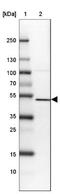 SET Domain Containing 7, Histone Lysine Methyltransferase antibody, NBP2-34101, Novus Biologicals, Western Blot image 