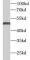 Fibrinogen Gamma Chain antibody, FNab03118, FineTest, Western Blot image 