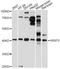 Cellular Communication Network Factor 6 antibody, A14812, ABclonal Technology, Western Blot image 