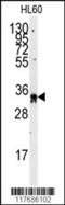Exosome Component 8 antibody, 61-502, ProSci, Western Blot image 