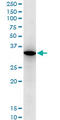 Retinoic Acid Receptor Responder 1 antibody, LS-C139175, Lifespan Biosciences, Western Blot image 