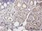 DNA Polymerase Beta antibody, H00005423-B01P, Novus Biologicals, Immunohistochemistry paraffin image 