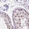 Heterogeneous Nuclear Ribonucleoprotein U Like 1 antibody, PA5-61983, Invitrogen Antibodies, Immunohistochemistry paraffin image 