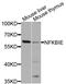 NFKB Inhibitor Epsilon antibody, STJ110741, St John