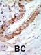 Mitogen-Activated Protein Kinase Kinase Kinase 8 antibody, abx033760, Abbexa, Immunohistochemistry paraffin image 